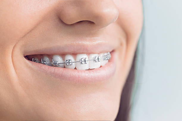 Best Invisalign and Clear Aligners  in Marion, TX